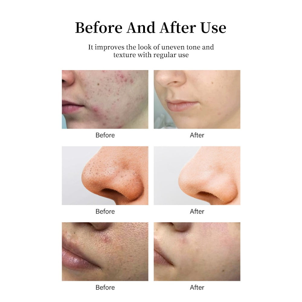 7% Glycolic Acid Exfoliating Toner Fruit Acid Toner Glycolic Acid Toner Moisturizing Toner 250mL