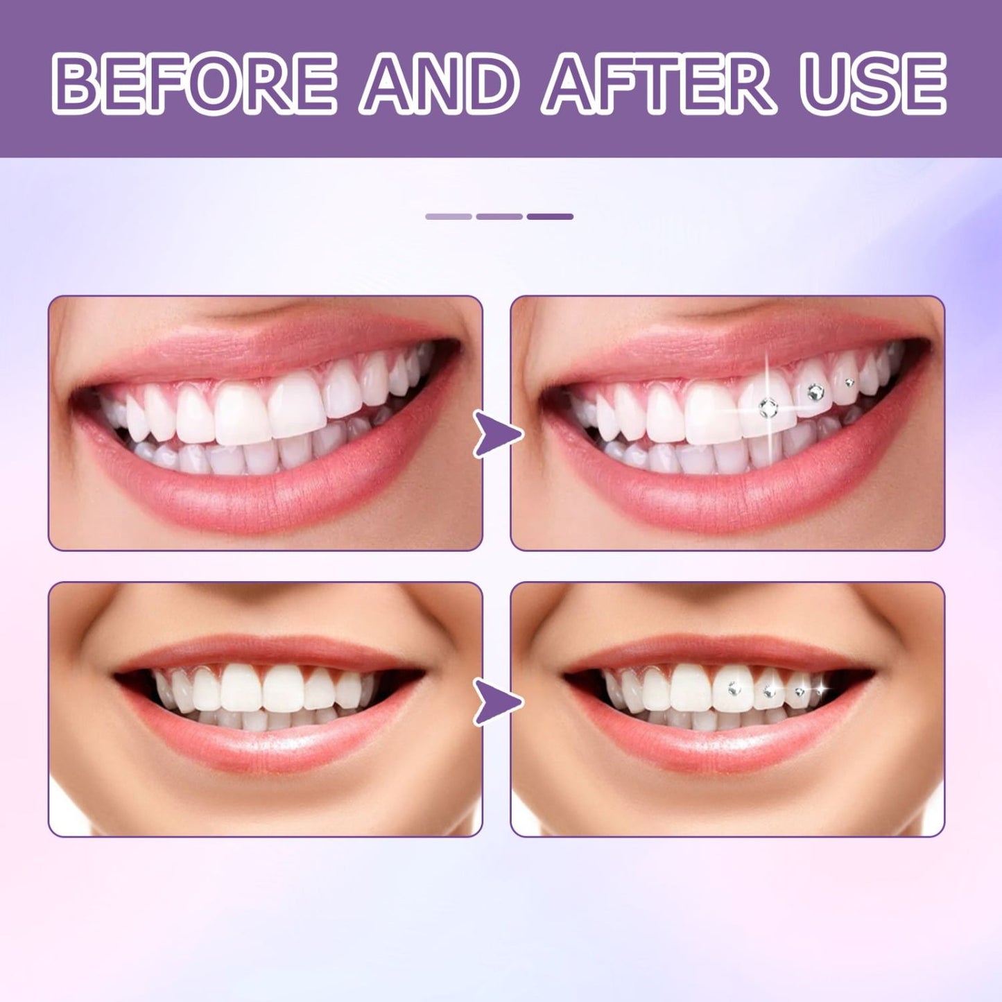 EELHOE UV Dental Gemstone Decoration Glue - DIY Fashion Jewelry Bonding - 1 Bottle 7 Ml.