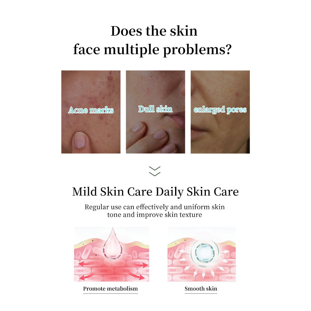 7% Glycolic Acid Exfoliating Toner Fruit Acid Toner Glycolic Acid Toner Moisturizing Toner 250mL