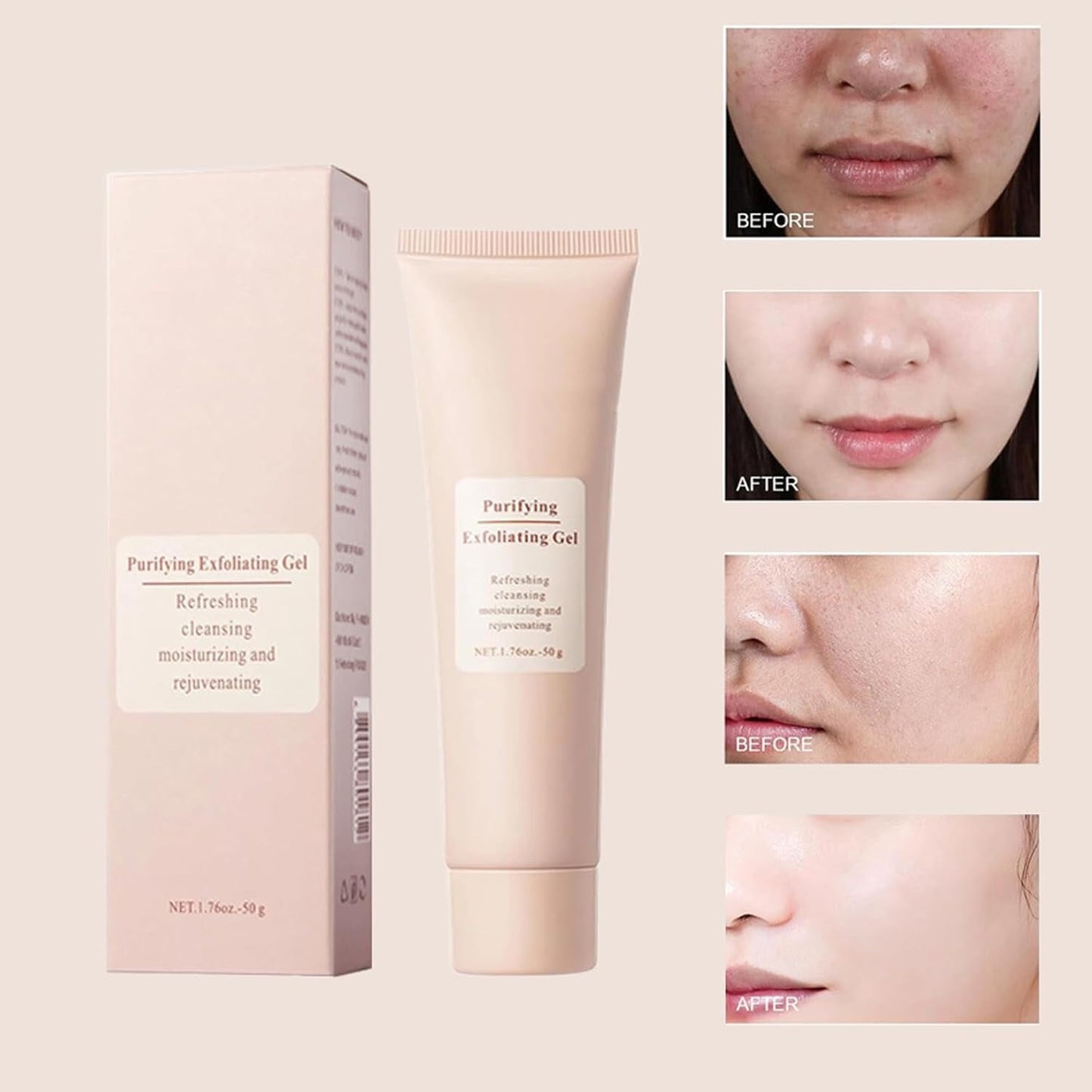 Purifying Exfoliating Gel, Purifying Exfoliating Gel Cream, Face and Body Exfoliating Scrub Gel for Face and Body